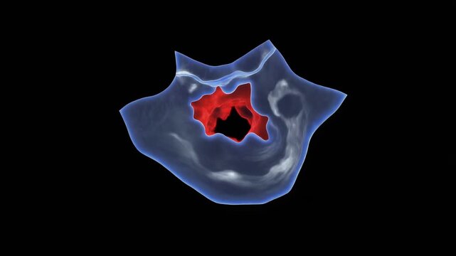 Saphenous Vein Valve Reflux Pockets Beneath Translucent Leg Anatomy for Medical Education