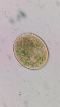 Microscopic view of Frontonia leucas ciliate with endosymbiotic Chlorella algae, light microscopy