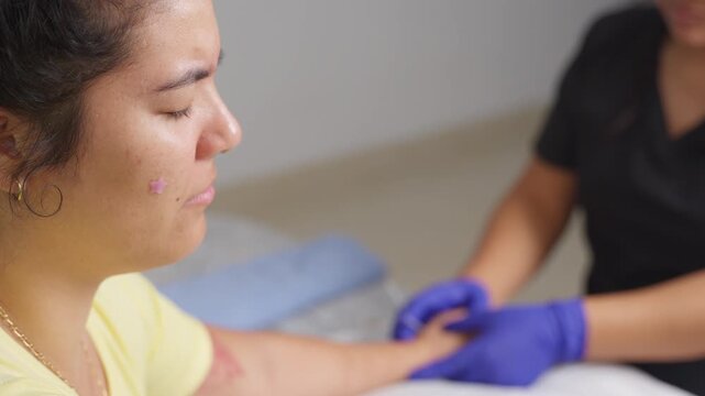 Acupuncturist applying dry needling physical therapy treatment