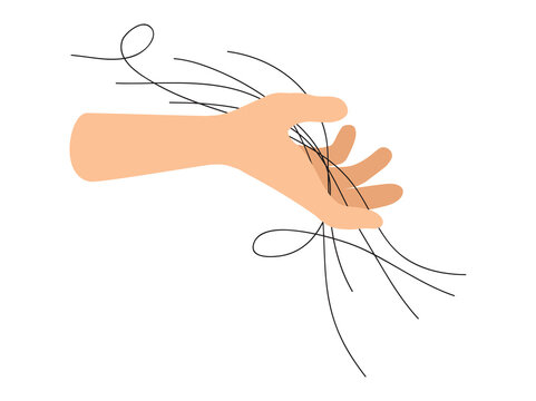 Hair Loss in Hand Illustration
