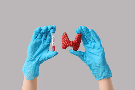 Thyroid health and medical diagnosis, doctor holding blood test tube and anatomical model of thyroid gland for endocrine system screening and analysis