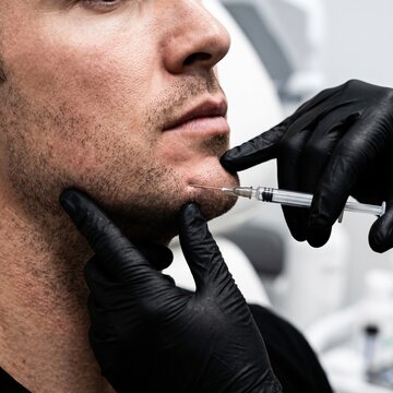 A bearded man receives a dermal filler injection into his chin area from a gloved specialist, a men's cosmetic and aesthetic treatment concept.