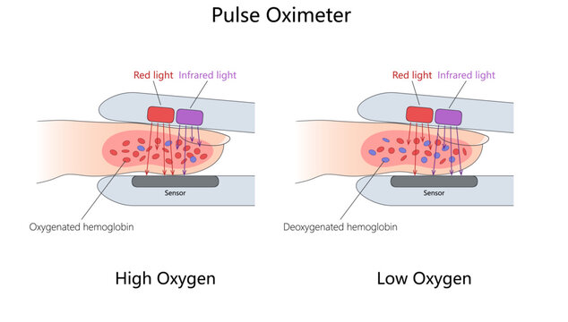 pulse oximeter uses red and infrared light to compare oxygenated and deoxygenated hemoglobin in blood diagram hand drawn schematic vector. Science educational illustration