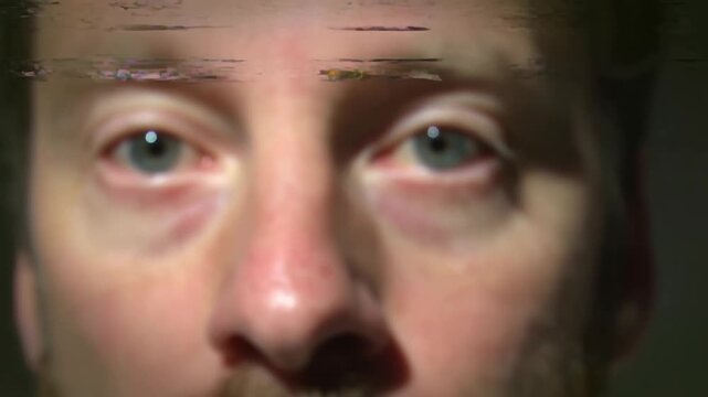 Extreme CloseUp of Human Face Blinking as Digital Glitches Distort the Image