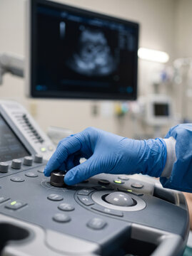 Sonographer Using Ultrasound Trackball Controller For Medical Diagnostic Examination