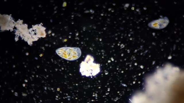 Ciliate protozoa feeding on diatoms microalgae under darkfield microscopy 