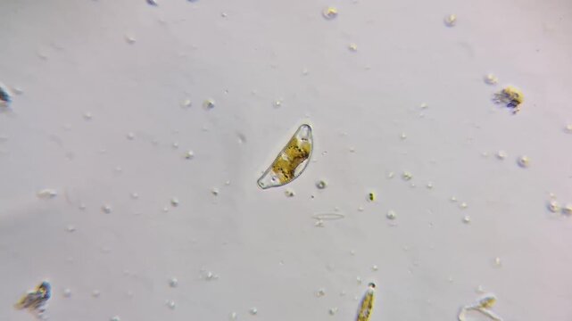 Diatom alga under microscope, unicellular organism Cymbella species, microscopic view of freshwater phytoplankton