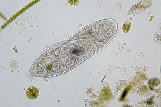 Protozoan with cilia in water sample, microbiology concept