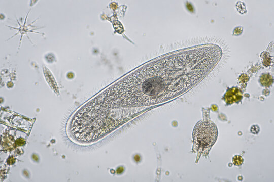 Protozoan with cilia in water sample, microbiology concept
