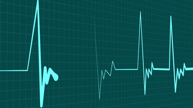 Heart monitor line medical pulse pattern with a flat section and sharp spikes animation