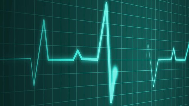 Irregular heartbeat line flat start and end, showing a medical ecg pattern and heart rhythm problem animation