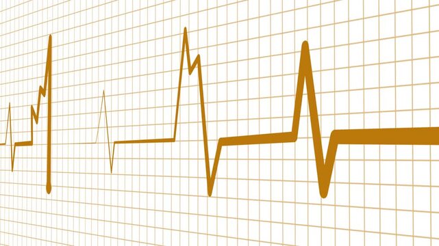 Abnormal heart rhythm line showing an ekg style medical waveform animation