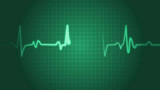 Ecg heartbeat line irregular pulse pattern medical background animation