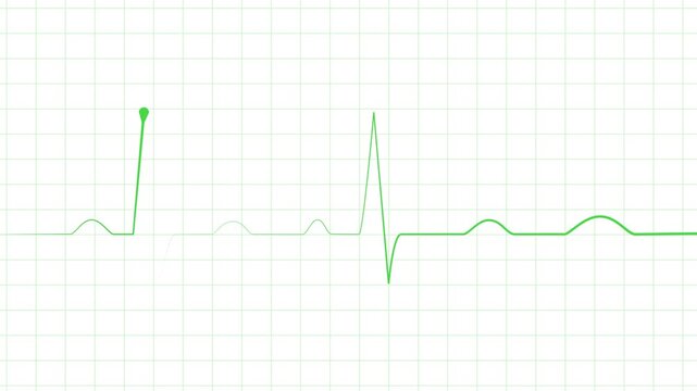 Heartbeat line electrocardiogram style pulse trace with sharp spikes and flat rhythm animation