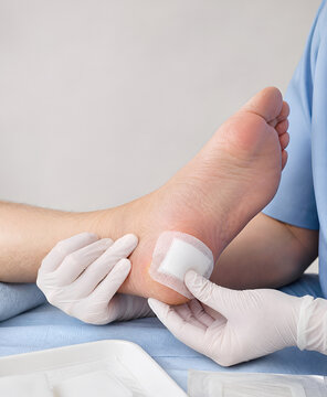 Medical professional treating a diabetic foot ulcer with sterile bandage
