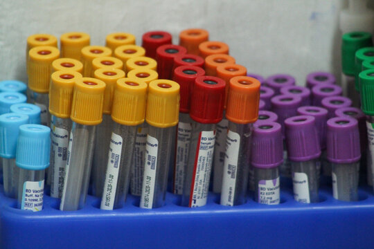 Probetas de colores
