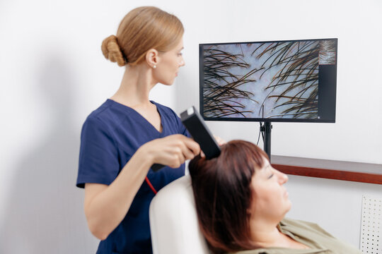 Closeup scalp analysis and hair clinic examination with handheld imaging device for medical consultation