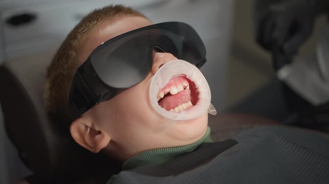 Close up of young boy lying back in dental chair with mouth open wearing protective eyewear and oral retractor during orthodontic procedure. Dental braces visible on teeth as soft lighting