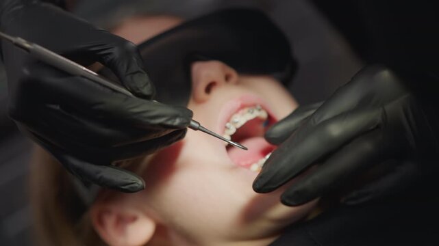Close up of young woman lying back with braces on her teeth while orthodontist wearing black gloves uses dental tools to adjust metal brackets and wires. scene is set in dimly lit clinical