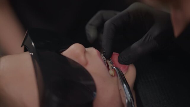 Close up of young woman lying down while orthodontist adjusts her braces using dental tools. focus remains on detailed interaction between gloved hands and teeth with soft lighting