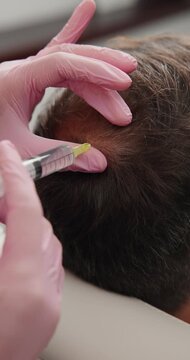 Closeup hair scalp injection for restoration at clinic for medical treatment alopecia.