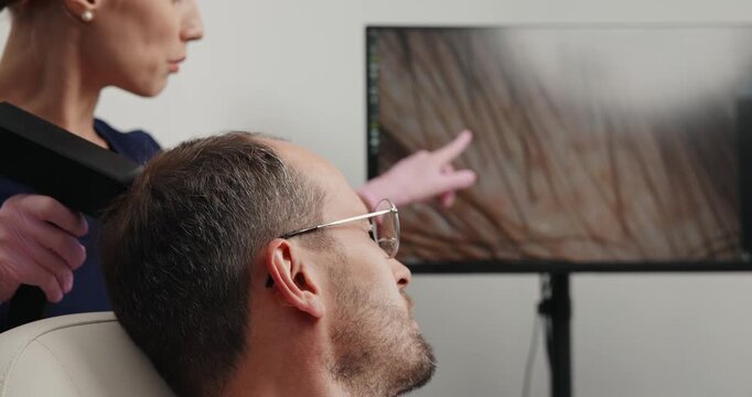 Portrait of male patient during scalp imaging with digital magnifier and monitor display for clinic consultation, concept alopecia for men.