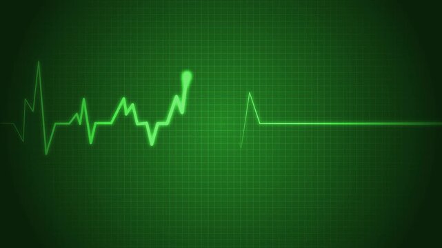 Healthcare Diagnostic Animation with Cardiac Pulse Wave, Emergency Heart Monitor Signal Animation with ECG Visualization