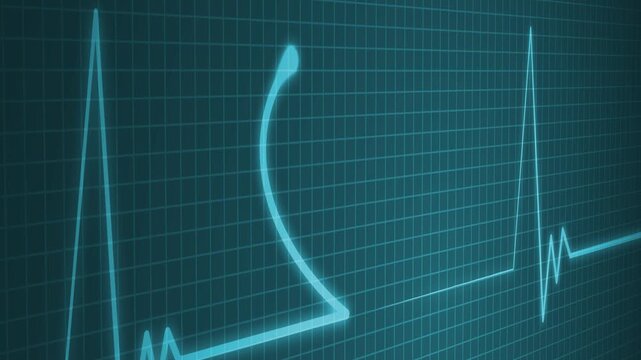 Healthcare Heartbeat Signal Motion Graphic for Medical Projects