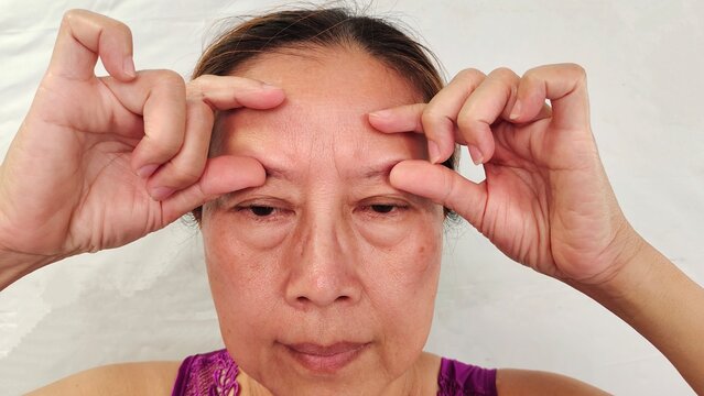 Woman with headache, forehead lines and scar, swelling and ptosis, Flabbiness and Flabby skin on the face, emotion and expression, health care and beauty concept.