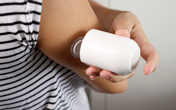 Close-up of a woman applying a continuous glucose monitoring (CGM) sensor to her arm using an applicator for diabetes control
