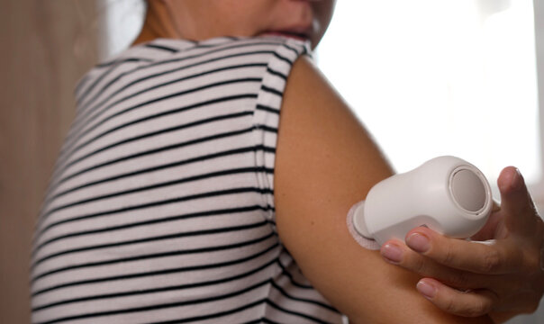 Close-up of a woman applying a continuous glucose monitoring (CGM) sensor to her arm using an applicator for diabetes control