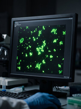Green Fluorescent Microscopy Analysis of Cells and Viruses on Computer Screen
