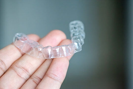  clear aligners device in the mouth on a white background. (invisalign)