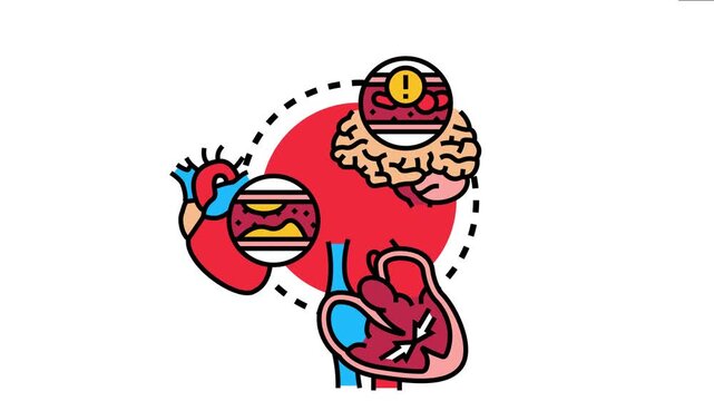 Cardiovascular disorder concept risk factors and consequences such as plaque buildup in arteries, brain blockage, and heart muscle damage, impacting human health