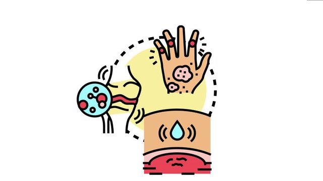 Rheumatoid arthritis causing inflamed joints, pain, and tissue damage, impacting health and bodily well being, commonly seen in hands and other body areas
