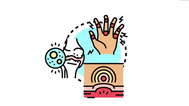 Rheumatoid arthritis impacting multiple joints, causing inflammation, discomfort, and cellular changes, representing a chronic autoimmune disease in the human body