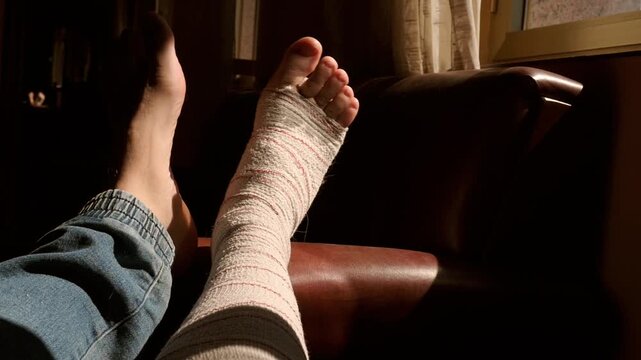 Injured person resting on a leather armchair with a bandaged leg. Concept of home recovery, medical care, and rehabilitation after an accident