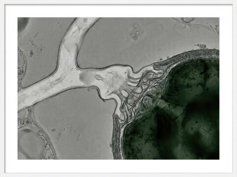 Fungal hypha penetrating algal cell under microscope, showcasing intricate details and textures