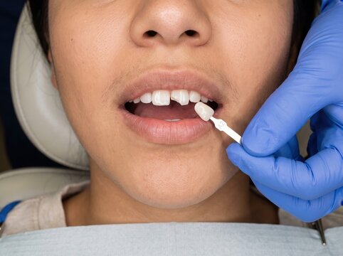 Dentist matching tooth shade guide to patient's teeth, patient care