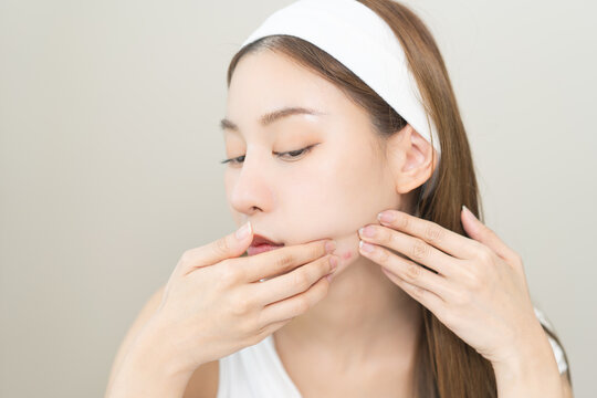 Expression worry asian young woman hand touching pustule around the chin and mouth, allergic when wear mask, makeup, show squeezing pimple spot from face. Beauty care, skin problem by acne treatment.
