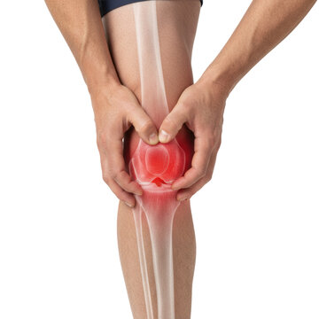 older caucasian man's lower leg and knee area, hand gripping the joint in pain. semi-transparent x-ray overlay highlights red osteoarthritic degradation. concept of chronic joint pain