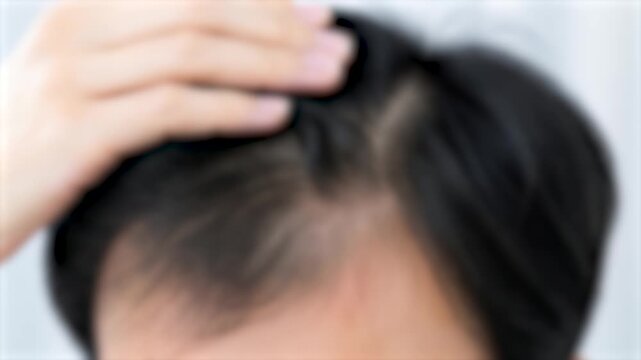 ぼかし背景素材：髪を触りながら薄毛を気にする中年男性の頭頂部のクローズアップイメージ　