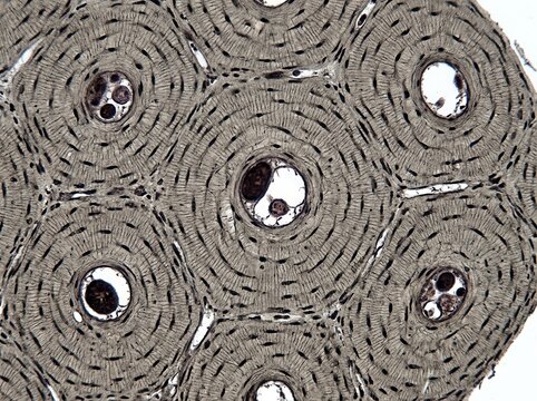 Microscopic View Of Compact Bone Structure