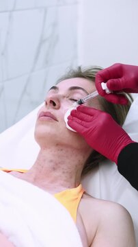 Vertical video. Rejuvenation procedure. Facial care. Professional woman cosmetician hands in red gloves using injection for anti-aging mesotherapy in beauty salon.