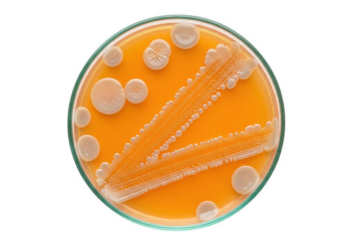 Bacterial colonies growing on an orange agar petri dish in a science laboratory isolated on transparent background