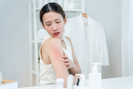 Skin and beauty problems Women have itchy skin and red rashes from cosmetic allergies, steroid allergies, sensitive skin, redness from sunlight, chemical allergies, rashes, insect bites.