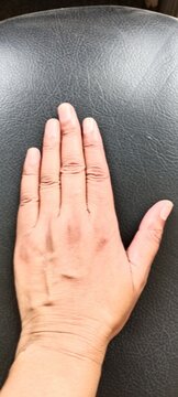 f left hand of fifty year old woman 