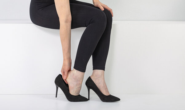 Woman putting on high heel shoes. Legs with visible varicose veins. Painful foot condition from wearing uncomfortable footwear. Healthcare concept for venous disease management