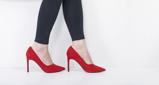 Woman wearing red high heel shoes on tired legs with visible veins. Concept of foot pain, vein health, and lifestyle discomfort caused by uncomfortable footwear. Medical aesthetic