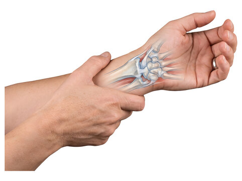 Close up hands holding painful wrist with carpal tunnel bone anatomy illustration